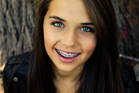 braces nude|Free Girl With Braces Photos .